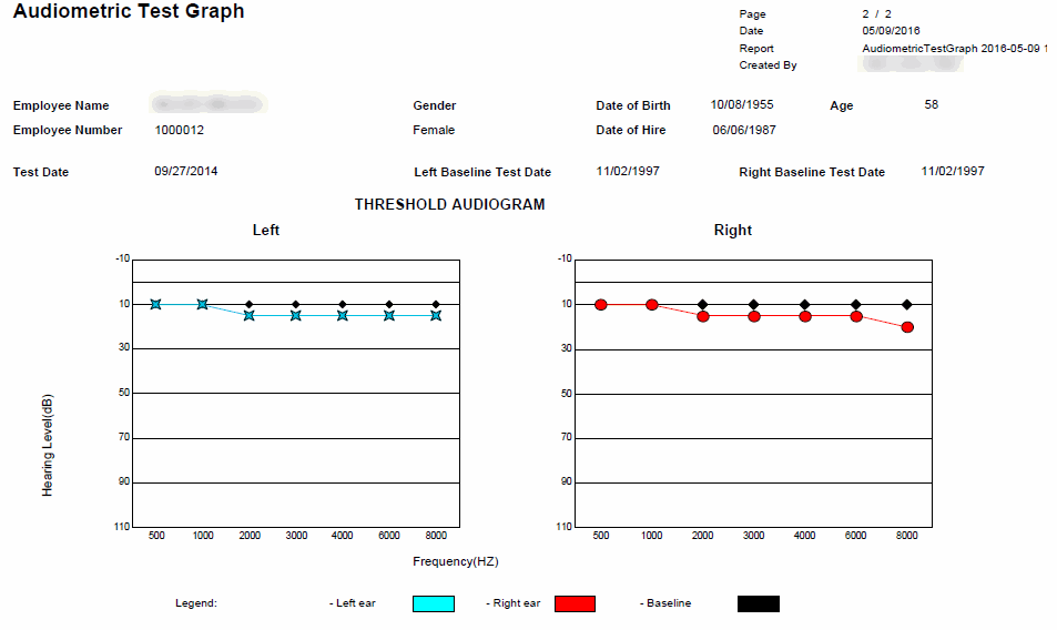 AT_Audiometric_Graph.gif